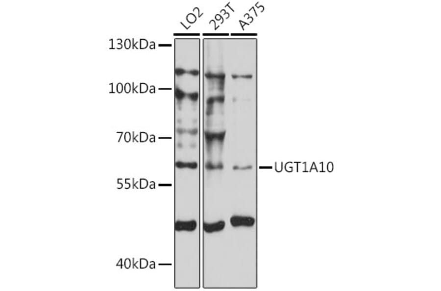 Western Blot - Anti-UGT1A10 Antibody (A90645) - Antibodies.com