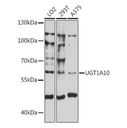 Western Blot - Anti-UGT1A10 Antibody (A90645) - Antibodies.com