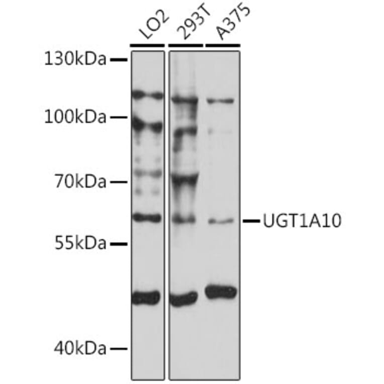 Western Blot - Anti-UGT1A10 Antibody (A90645) - Antibodies.com