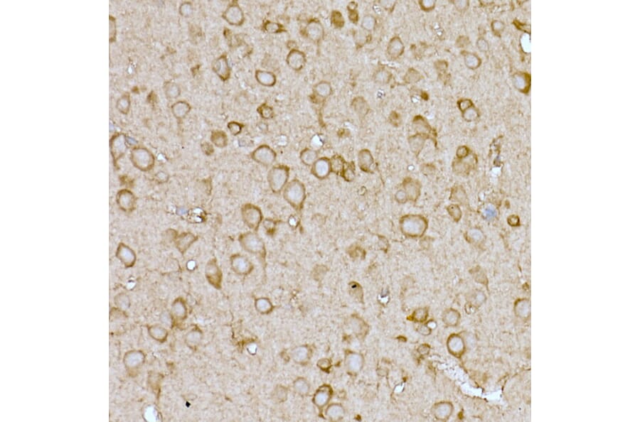 Immunohistochemistry - Anti-SLC7A1 Antibody (A90646) - Antibodies.com