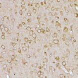 Immunohistochemistry - Anti-SLC7A1 Antibody (A90646) - Antibodies.com