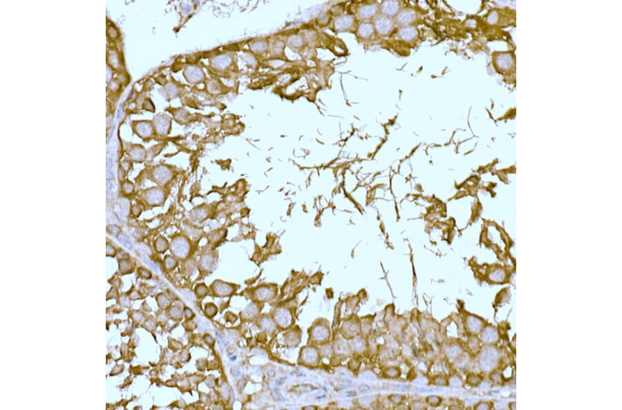 Immunohistochemistry - Anti-SLC7A1 Antibody (A90646) - Antibodies.com