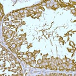 Immunohistochemistry - Anti-SLC7A1 Antibody (A90646) - Antibodies.com