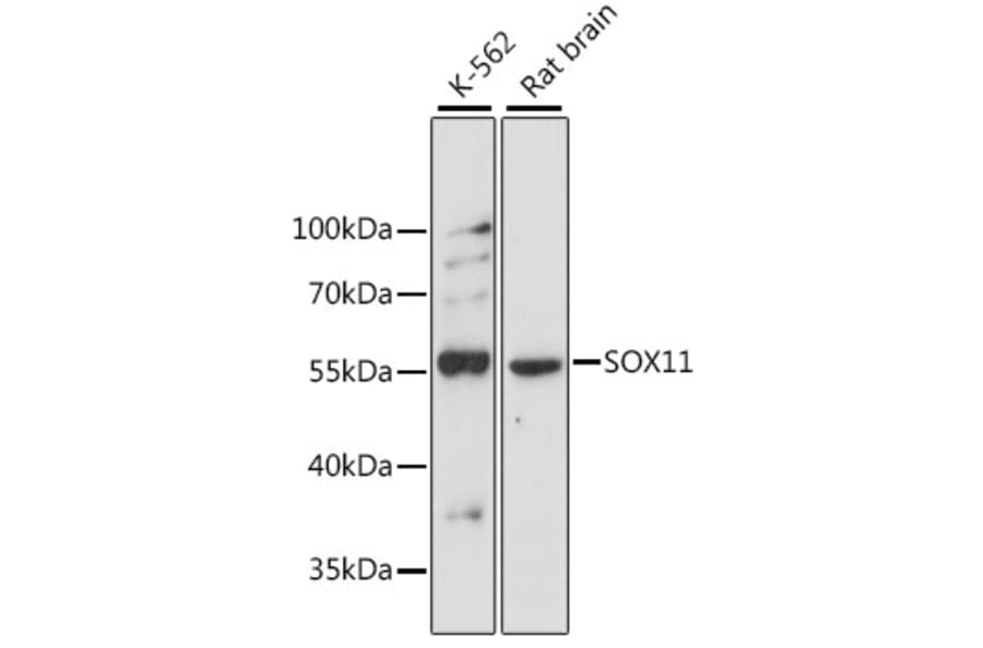 Western Blot - Anti-SOX11 Antibody (A15589) - Antibodies.com