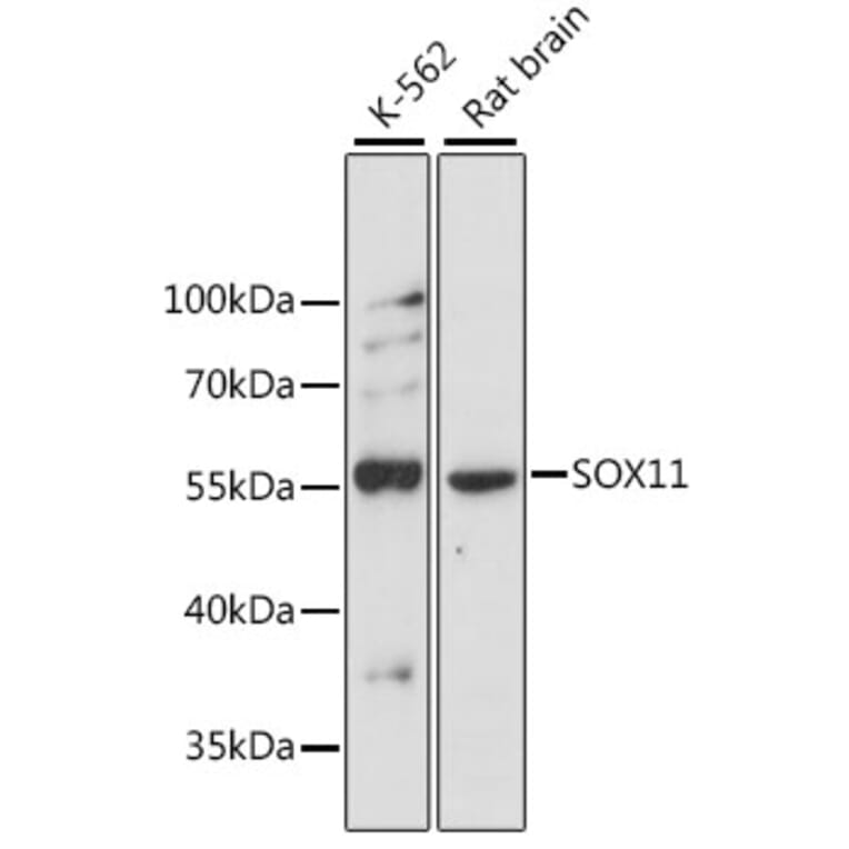 Western Blot - Anti-SOX11 Antibody (A15589) - Antibodies.com