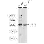 Western Blot - Anti-SOX11 Antibody (A15589) - Antibodies.com