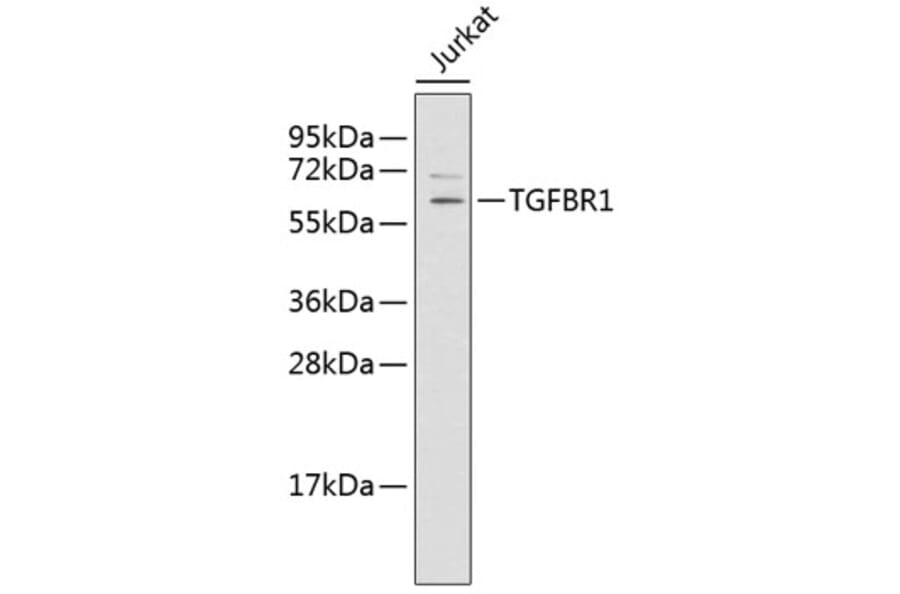 Western Blot - Anti-TGFBR1 Antibody (A6508) - Antibodies.com