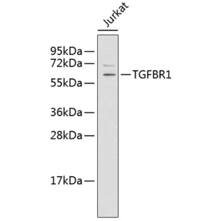 Western Blot - Anti-TGFBR1 Antibody (A6508) - Antibodies.com