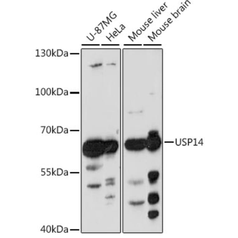 Western Blot - Anti-USP14/TGT Antibody (A90649) - Antibodies.com