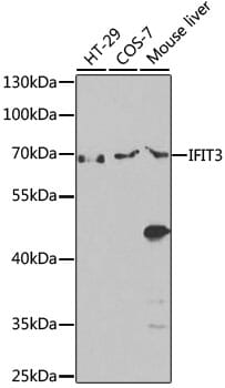 Western blot analysis of extracts of various cell lines, using Anti-IFIT3 Antibody (A14004) at 1:1,000 dilution.
Secondary antibody: Goat Anti-Rabbit IgG (H+L) (HRP) (AS014) at 1:10,000 dilution.
Lysates / proteins: 25µg per lane.
Blocking buffer: 3% non-fat dry milk in TBST.
Detection: ECL Enhanced Kit (RM00021).
Exposure time: 90s.