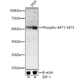 Western Blot - Anti-AKT1 (phospho Ser473) Antibody (A90652) - Antibodies.com