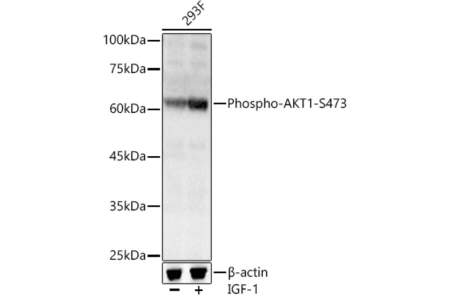 Western Blot - Anti-AKT1 (phospho Ser473) Antibody (A90652) - Antibodies.com