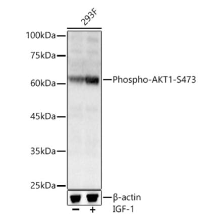 Western Blot - Anti-AKT1 (phospho Ser473) Antibody (A90652) - Antibodies.com