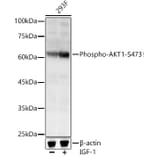 Western Blot - Anti-AKT1 (phospho Ser473) Antibody (A90652) - Antibodies.com