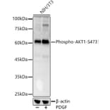 Western Blot - Anti-AKT1 (phospho Ser473) Antibody (A90652) - Antibodies.com