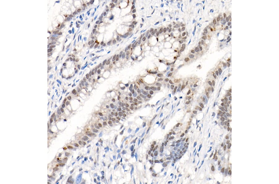 Immunohistochemistry - Anti-AKT1 (phospho Ser473) Antibody (A90652) - Antibodies.com