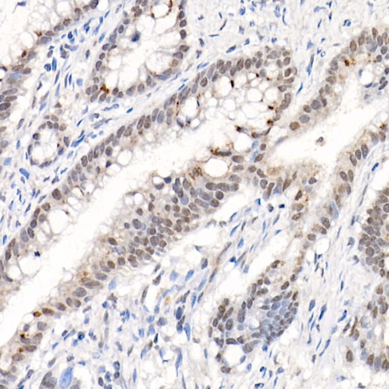 Immunohistochemistry - Anti-AKT1 (phospho Ser473) Antibody (A90652) - Antibodies.com