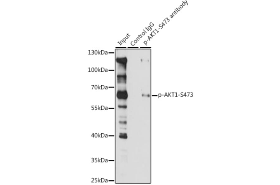 Western Blot - Anti-AKT1 (phospho Ser473) Antibody (A90652) - Antibodies.com