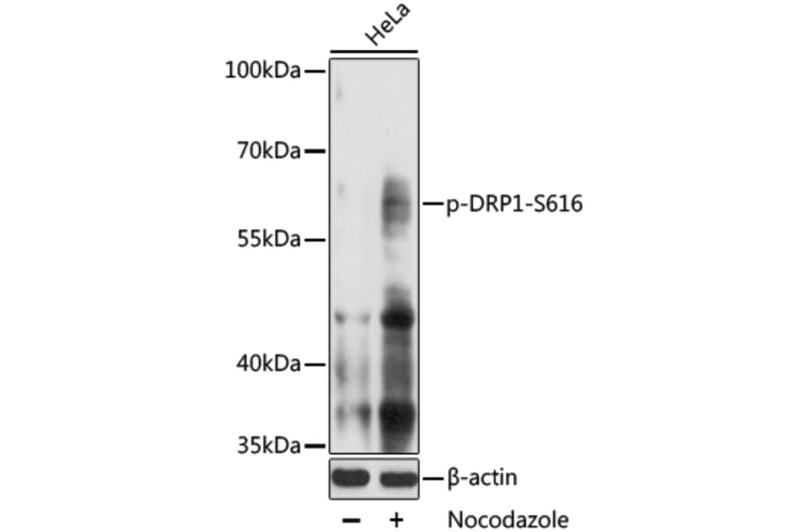 Western Blot - Anti-DRP1 (phospho S616) Antibody (AP0849) - Antibodies.com