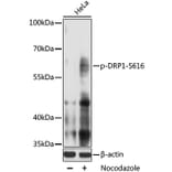 Western Blot - Anti-DRP1 (phospho S616) Antibody (AP0849) - Antibodies.com