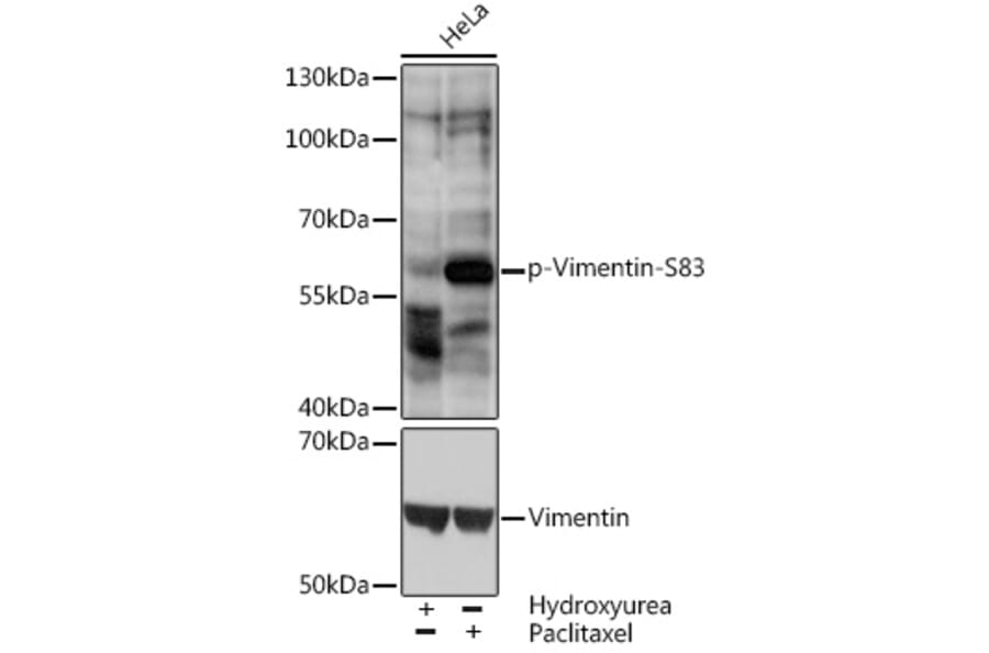 Western Blot - Anti-Vimentin (phospho Ser83) Antibody (A90654) - Antibodies.com
