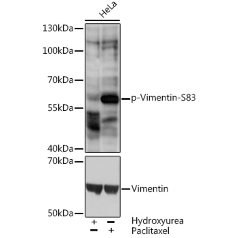 Western Blot - Anti-Vimentin (phospho Ser83) Antibody (A90654) - Antibodies.com