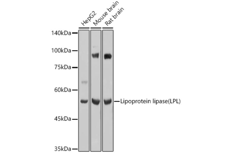 Western Blot - Anti-Lipoprotein lipase Antibody (A90656) - Antibodies.com