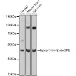 Western Blot - Anti-Lipoprotein lipase Antibody (A90656) - Antibodies.com