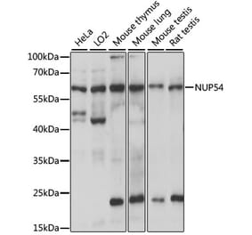 Western Blot - Anti-NUP54 Antibody (A90657) - Antibodies.com