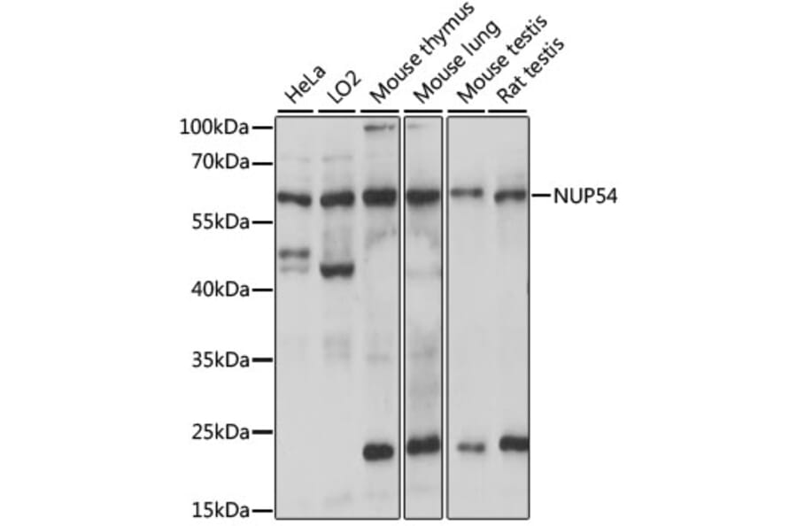 Western Blot - Anti-NUP54 Antibody (A90657) - Antibodies.com
