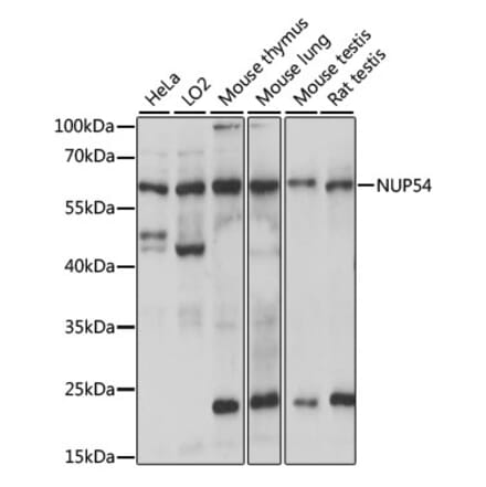 Western Blot - Anti-NUP54 Antibody (A90657) - Antibodies.com