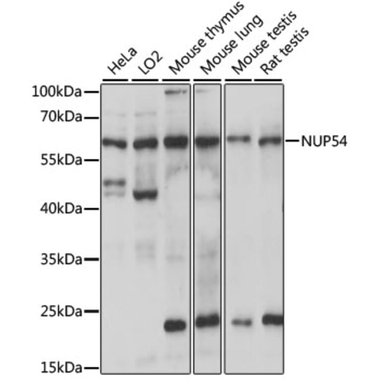 Western Blot - Anti-NUP54 Antibody (A90657) - Antibodies.com