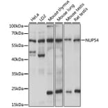 Western Blot - Anti-NUP54 Antibody (A90657) - Antibodies.com