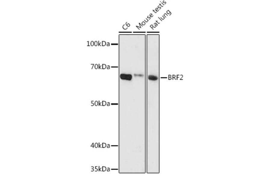 Western Blot - Anti-BRF2 Antibody (A90659) - Antibodies.com