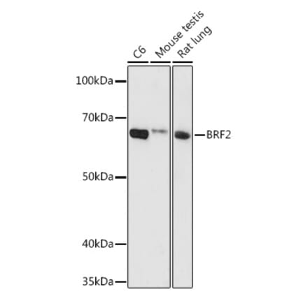 Western Blot - Anti-BRF2 Antibody (A90659) - Antibodies.com
