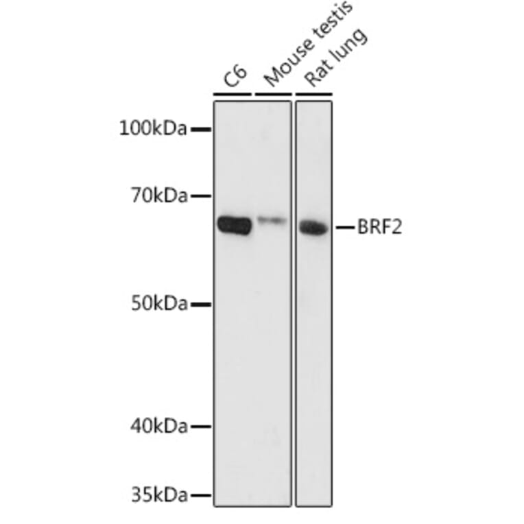 Western Blot - Anti-BRF2 Antibody (A90659) - Antibodies.com