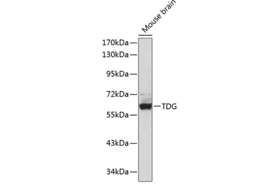 Western Blot - Anti-TDG Antibody (A90660) - Antibodies.com