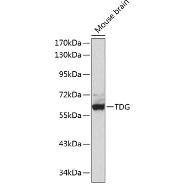 Western Blot - Anti-TDG Antibody (A90660) - Antibodies.com