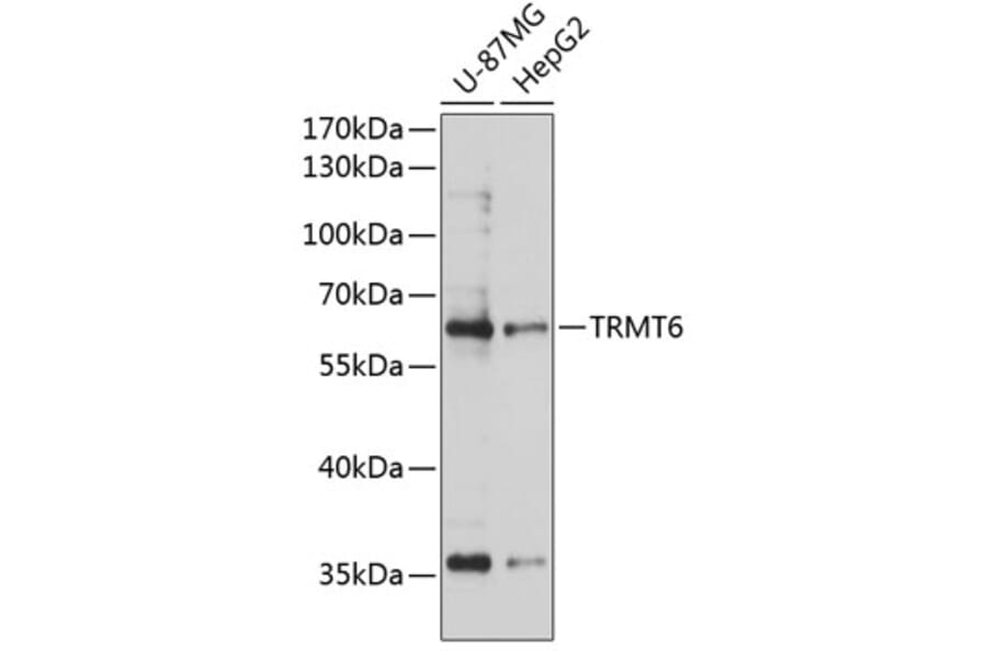Western Blot - Anti-TRMT6 Antibody (A90661) - Antibodies.com
