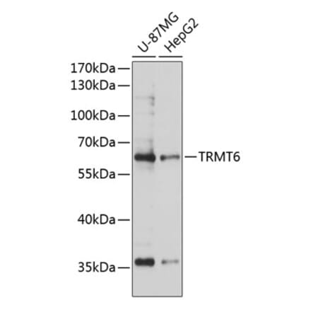 Western Blot - Anti-TRMT6 Antibody (A90661) - Antibodies.com