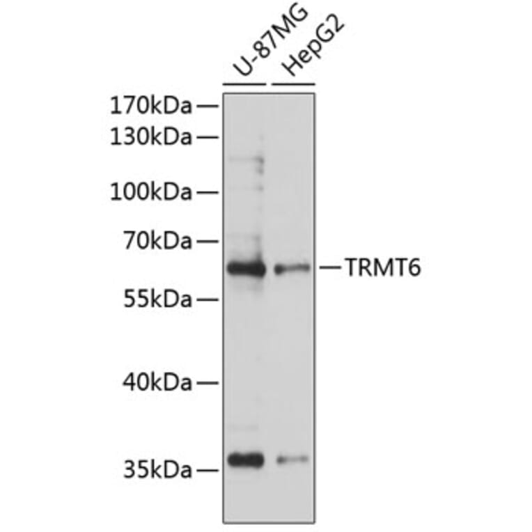 Western Blot - Anti-TRMT6 Antibody (A90661) - Antibodies.com