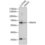 Western Blot - Anti-TRMT6 Antibody (A90661) - Antibodies.com
