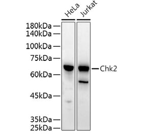 Western Blot - Anti-Chk2 Antibody (A90663) - Antibodies.com