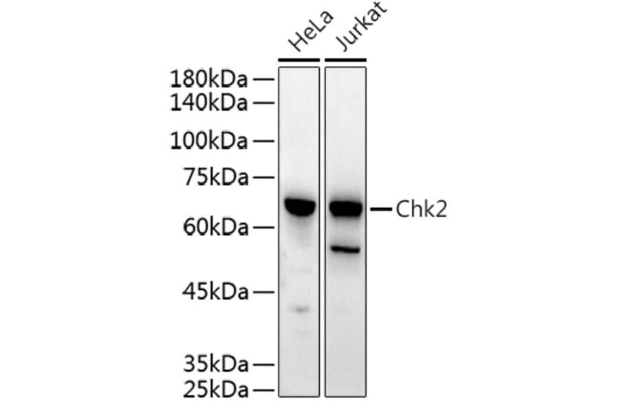 Western Blot - Anti-Chk2 Antibody (A90663) - Antibodies.com