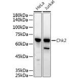 Western Blot - Anti-Chk2 Antibody (A90663) - Antibodies.com