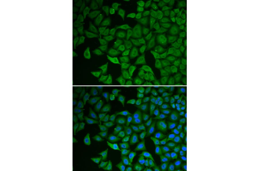 Immunofluorescence - Anti-Chk2 Antibody (A90663) - Antibodies.com
