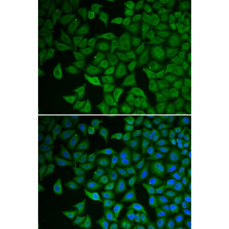 Immunofluorescence - Anti-Chk2 Antibody (A90663) - Antibodies.com