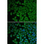 Immunofluorescence - Anti-Chk2 Antibody (A90663) - Antibodies.com