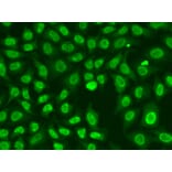 Immunofluorescence - Anti-Chk2 Antibody (A90663) - Antibodies.com