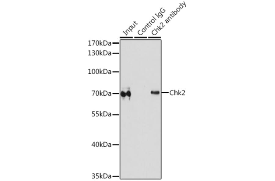 Western Blot - Anti-Chk2 Antibody (A90663) - Antibodies.com